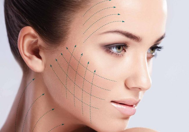 silhouette thread lift