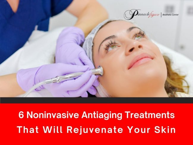 6-Noninvasive-Antiaging-Treatments-That-Will-Rejuvenate-Your-Skin 6 Noninvasive Antiaging Treatments That Will Rejuvenate Your Skin