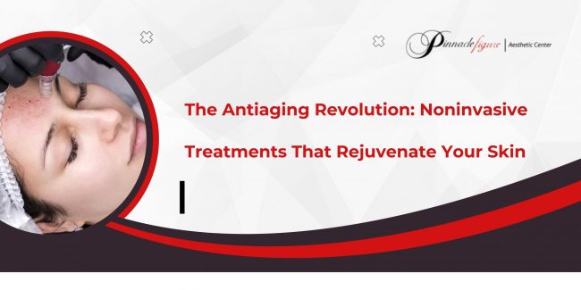 The-Anti-Aging-Revolution-Noninvasive-Treatments-That-Rejuvenate-Your-Skin The Anti-Aging Revolution: Noninvasive Treatments That Rejuvenate Your Skin