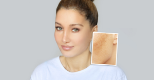 body whitening treatment