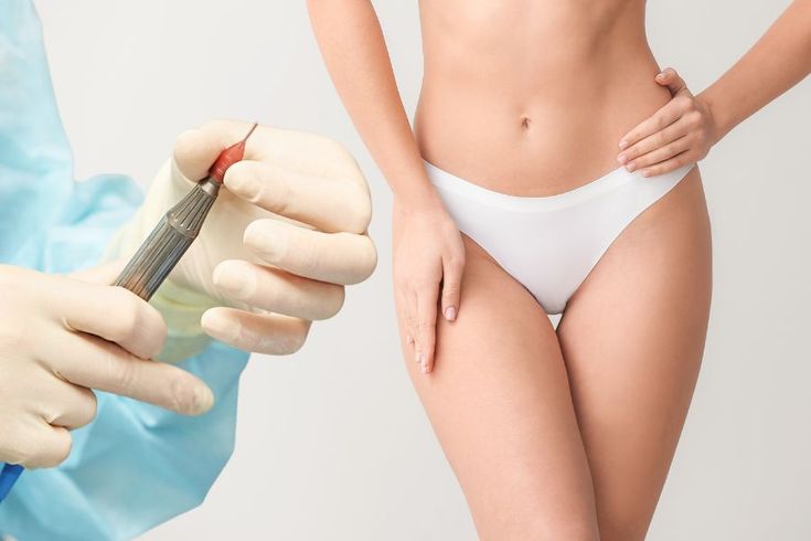 Labiaplasty in Johor Bahru