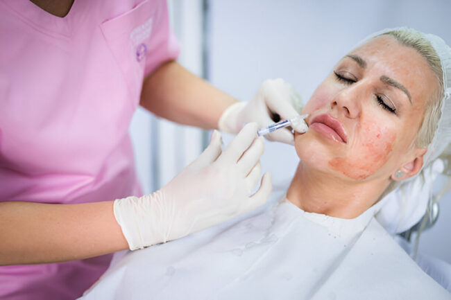 Skin Booster Injections in JB